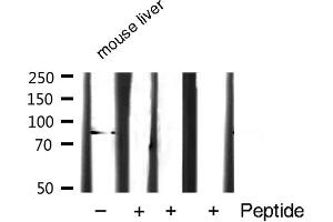 Western blot analysis of STAT3 expression in Mouse liver lysate (STAT3 抗体  (C-Term))