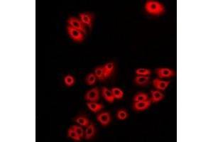 Immunofluorescent analysis of Atlastin-1 staining in A549 cells. (ATL1 抗体)