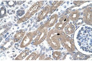 Immunohistochemistry (IHC) image for anti-Tryptophan 2,3-Dioxygenase (TDO2) (N-Term) antibody (ABIN2782334) (TDO2 抗体  (N-Term))