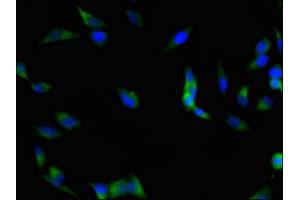 Immunofluorescent analysis of Hela cells using ABIN7152982 at dilution of 1:100 and Alexa Fluor 488-congugated AffiniPure Goat Anti-Rabbit IgG(H+L) (FAK 抗体  (AA 363-464))