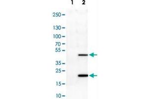Western Blot analysis of Lane 1: negative control (vector only transfected HEK293T cell lysate) and Lane 2: over-expression lysate (co-expressed with a C-terminal myc-DDK tag in mammalian HEK293T cells) with ASRGL1 monoclonal antibody, clone CL1679 . (ASRGL1 抗体)