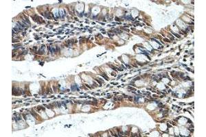 Immunohistochemical staining of formalin-fixed paraffin-embedded human fetal small intestine tissue showing cytoplasmic staining with NUDT7 polyclonal antibody  at 1 : 100 dilution. (NUDT7 抗体  (AA 2-236))