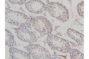 Immunohistochemistry (IHC) image for anti-Cofilin 1 (CFL1) (pSer3) antibody (ABIN6255180)