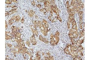 IHC analysis of CDK5 using anti-CDK5 antibody (ABIN6719393). (CDK5 抗体  (AA 1-226))