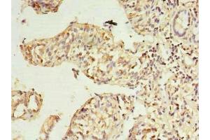 Immunohistochemistry of paraffin-embedded human small intestine tissue using ABIN7168501 at dilution of 1:100 (RWDD2A 抗体  (AA 1-292))