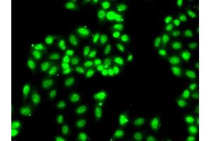 Immunofluorescence analysis of A549 cells using HNRNPA1 antibody. (HNRNPA1 抗体)