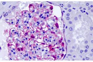 Anti-CLIC5 antibody IHC staining of human kidney, glomeruli.