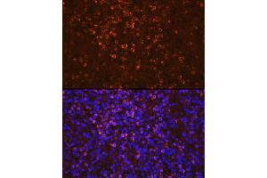 Immunofluorescence analysis of human spleen cells using Lipocalin-2/NGAL Rabbit pAb (ABIN3022890, ABIN3022891, ABIN3022892 and ABIN6219282) at dilution of 1:100 (40x lens). (Lipocalin 2 抗体  (AA 21-198))