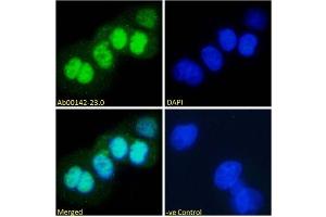 Immunofluorescence staining of fixed A431 with anti-p53 antibody (ABIN5668085) Immunofluorescence analysis of paraformaldehyde fixed A431 cells, permeabilized with 0. (Recombinant p53 抗体  (AA 371-380))