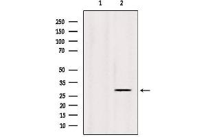 Western blot analysis of extracts from Sp2/0, using INSIG1 Antibody. (INSIG1 抗体  (Internal Region))