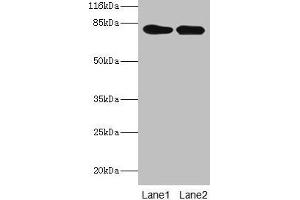 Western blot All lanes: LHCGR antibody at 2 μg/mL Lane 1: Mouse brain tissue Lane 2: Mouse kidney tissue Secondary Goat polyclonal to rabbit IgG at 1/10000 dilution Predicted band size: 79, 72 kDa Observed band size: 79 kDa (LHCGR 抗体  (AA 27-363))