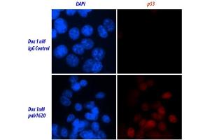 Image no. 2 for anti-Tumor Protein P53 (TP53) (Wild Type) antibody (ABIN2704419)