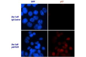 Image no. 2 for anti-Tumor Protein P53 (TP53) (Wild Type) antibody (ABIN2704419) (p53 抗体  (Wild Type))