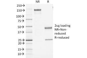 SDS-PAGE Analysis Purified CD45 Monoclonal Antibody (PTPRC/1461). (CD45 抗体)