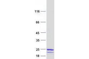 Western Blotting (WB) image for Ubiquitin-Conjugating Enzyme E2C (UBE2C) (Transcript Variant 4) protein (Myc-DYKDDDDK Tag) (ABIN2734784)