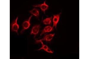 Immunofluorescence (fixed cells) (IF/ICC) image for anti-Zinc Finger, HIT-Type Containing 6 (ZNHIT6) (Internal Region) antibody (ABIN6257046)