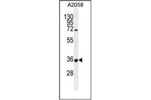 Western blot analysis of OR7G1 Antibody (N-term) in A2058 cell line lysates (35ug/lane). (OR7G1 抗体  (N-Term))
