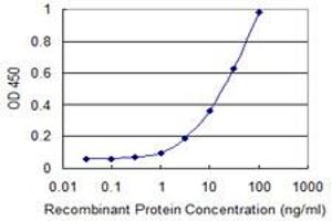 Detection limit for recombinant GST tagged RCC1 is 0. (RCC1 抗体  (AA 312-421))