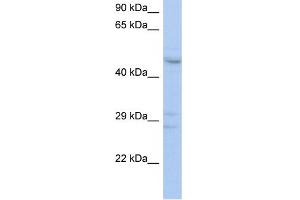 WB Suggested Anti-ACPL2 Antibody Titration:  0. (ACPL2 抗体  (Middle Region))