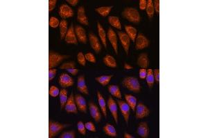Immunofluorescence analysis of L929 cells using GOLG Rabbit pAb (ABIN6129790, ABIN6141266, ABIN6141267 and ABIN6214379) at dilution of 1:100 (40x lens). (GOLGA4 抗体  (AA 1-150))