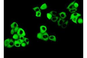 Immunohistochemistry (IHC) image for anti-Cystatin B (Stefin B) (CSTB) (AA 1-98) antibody (ABIN1077970)