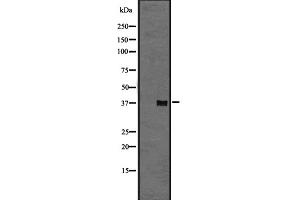 Western blot analysis of GPR6 expression in A431 whole cell lysate ,The lane on the left is treated with the antigen-specific peptide.