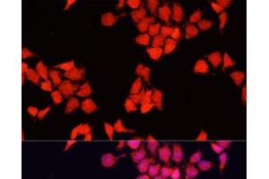 Immunofluorescence analysis of HeLa cells using FXR1 Polyclonal Antibody at dilution of 1:100. (FXR1 抗体)