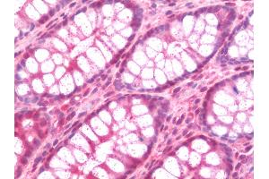 Anti-STUB1 / CHIP antibody IHC staining of human colon. (STUB1 抗体  (AA 17-303))