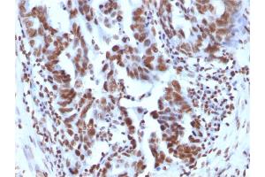 Immunohistochemistry (IHC) image for anti-Histone H1 antibody (ABIN6939596)