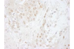 anti-COP9 Constitutive Photomorphogenic Homolog Subunit 5 (Arabidopsis) (COPS5) (AA 175-225) antibody