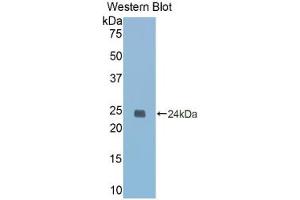 Western blot analysis of the recombinant protein. (Caspase 1 抗体  (AA 119-296))