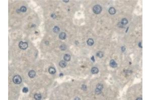 Detection of ErbB4 in Human Liver Tissue using Polyclonal Antibody to Erb-b2 Receptor Tyrosine Kinase 4 (ErbB4) (ERBB4 抗体  (AA 29-278))