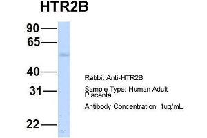 Host:  Rabbit  Target Name:  HTR2B  Sample Type:  Human Adult Placenta  Antibody Dilution:  1. (Serotonin Receptor 2B 抗体  (N-Term))
