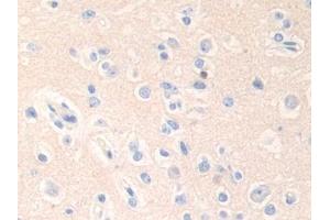 DAB staining on IHC-P; Samples: Human Cerebrum Tissue (Epsin 1 抗体  (AA 279-437))