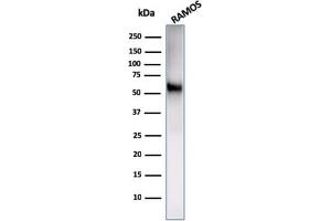 Western Blotting (WB) image for anti-CD86 (CD86) antibody (ABIN6941145)