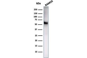 Western Blot Analysis of Ramos cell lysate using CD86 Rabbit Recombinant Monoclonal Antibody (C86/2160R). (Recombinant CD86 抗体)