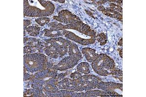 IHC analysis of NKCC1/SLC12A2 using anti-NKCC1/SLC12A2 antibody (ABIN7602601).
