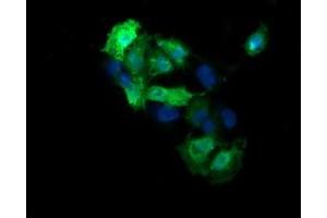 Image no. 2 for anti-Mitogen-Activated Protein Kinase Kinase 3 (MAP2K3) antibody (ABIN1499405)