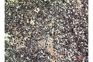 Immunohistochemistry (IHC) analysis of paraffin-embedded Human Lymph Nodes, antibody was diluted at 1:100. (HDGFRP3 抗体  (Internal Region))