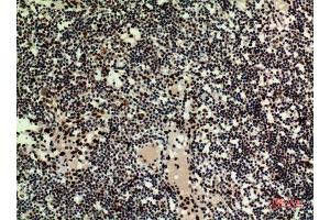 Immunohistochemistry (IHC) analysis of paraffin-embedded Human Lymph Nodes, antibody was diluted at 1:100.