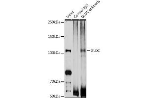 Immunoprecipitation analysis of 200 μg extracts of DU145 cells using 3 μg GLDC antibody (ABIN6132011, ABIN6141119, ABIN6141120 and ABIN6225260). (GLDC 抗体  (AA 36-290))