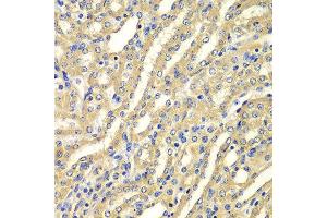 Immunohistochemistry of paraffin-embedded mouse kidney using WIPI2 antibody at dilution of 1:100 (x400 lens).
