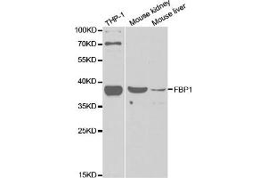 Western Blotting (WB) image for anti-Fructose-1,6-Bisphosphatase 1 (FBP1) antibody (ABIN1876594) (FBP1 抗体)