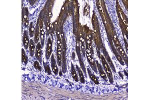Immunohistochemistry (IHC) image for anti-Cytochrome C Oxidase Subunit IV Isoform 1 (COX4I1) (AA 59-169) antibody (ABIN5692827)