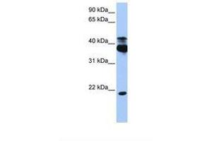 Image no. 1 for anti-serine/threonine Kinase 38 (STK38) (AA 368-417) antibody (ABIN6738495) (STK38 抗体  (AA 368-417))
