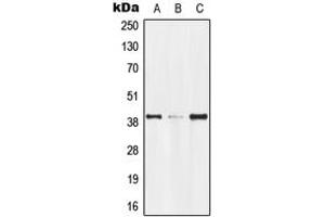 Western blot analysis of GPR174 expression in Jurkat (A), mouse kidney (B), rat kidney (C) whole cell lysates. (GPR174 抗体  (Center))