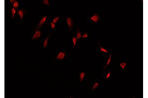 ABIN6266508 staining A549  cells by IF/ICC. (Claudin 2 抗体  (C-Term))