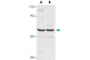 Western blot analysis of CARD9 expression in human MDA-MB-361 (A) and PC-3 (B) cell lysate with CARD9 polyclonal antibody  at 2. (CARD9 抗体  (AA 521-536))