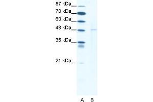 WB Suggested Anti-DEK Antibody Titration:  1. (DEK 抗体  (N-Term))