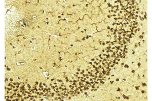 ABIN6268842 at 1/100 staining Mouse brain tissue by IHC-P. (MGMT 抗体  (N-Term))